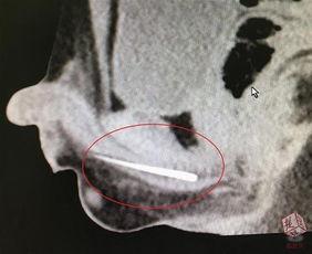 尿道视频在线,视频解析人体私密部位健康奥秘