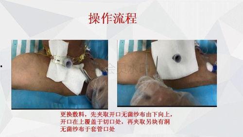 清宫丸使用方法视频,轻松掌握健康养生之道